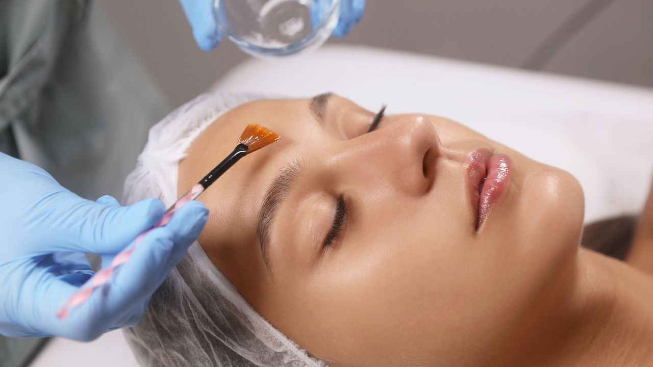 Medspa Aurora chemical peel